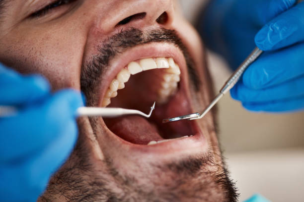 Best Broken Tooth Emergency  in Washington, IA